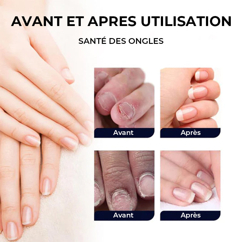 Solution de soin des ongles