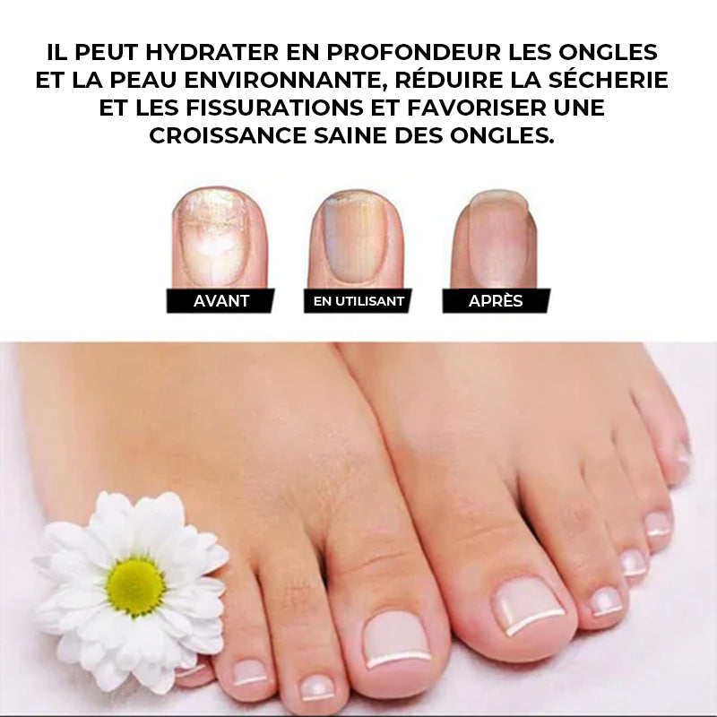 Solution de soin des ongles