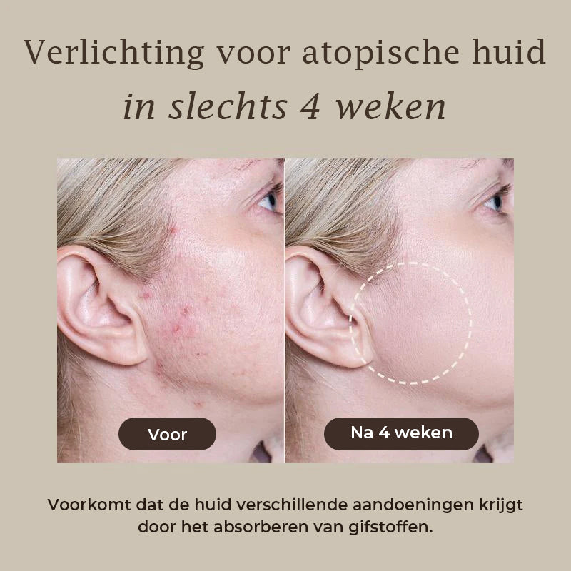 Relief moddermasker